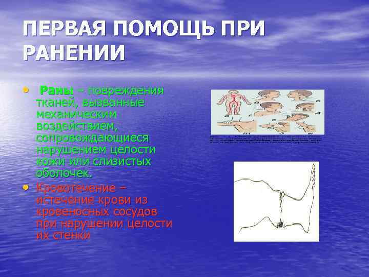 ПЕРВАЯ ПОМОЩЬ ПРИ РАНЕНИИ • Раны – повреждения • тканей, вызванные механическим воздействием, сопровождающиеся