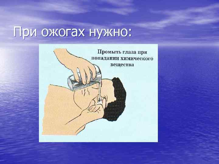 При ожогах нужно: 