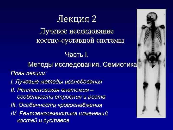 Лекция 2 Лучевое исследование костно-суставной системы Часть I. Методы исследования. Семиотика. План лекции: I.