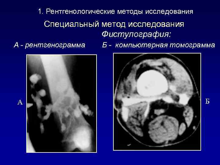 Рентгенологические методы исследования фото