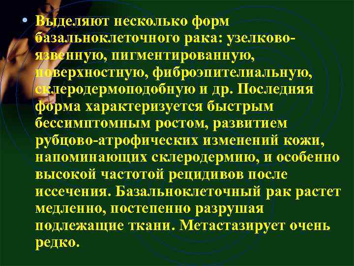  • Выделяют несколько форм базальноклеточного рака: узелковоязвенную, пигментированную, поверхностную, фиброэпителиальную, склеродермоподобную и др.