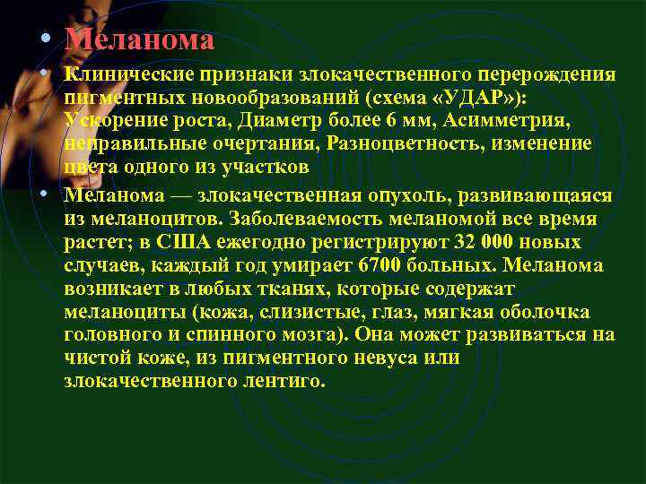  • Меланома • Клинические признаки злокачественного перерождения пигментных новообразований (схема «УДАР» ): Ускорение