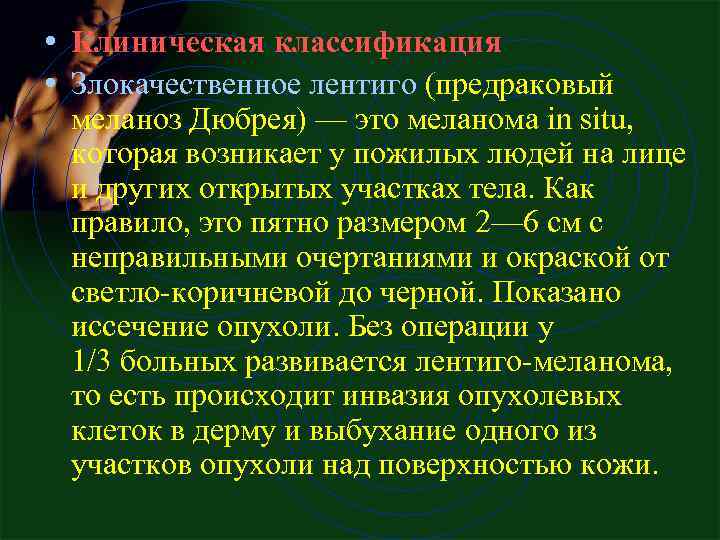  • Клиническая классификация • Злокачественное лентиго (предраковый меланоз Дюбрея) — это меланома in