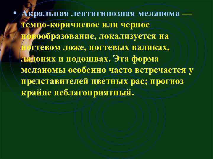  • Акральная лентигинозная меланома — темно-коричневое или черное новообразование, локализуется на ногтевом ложе,