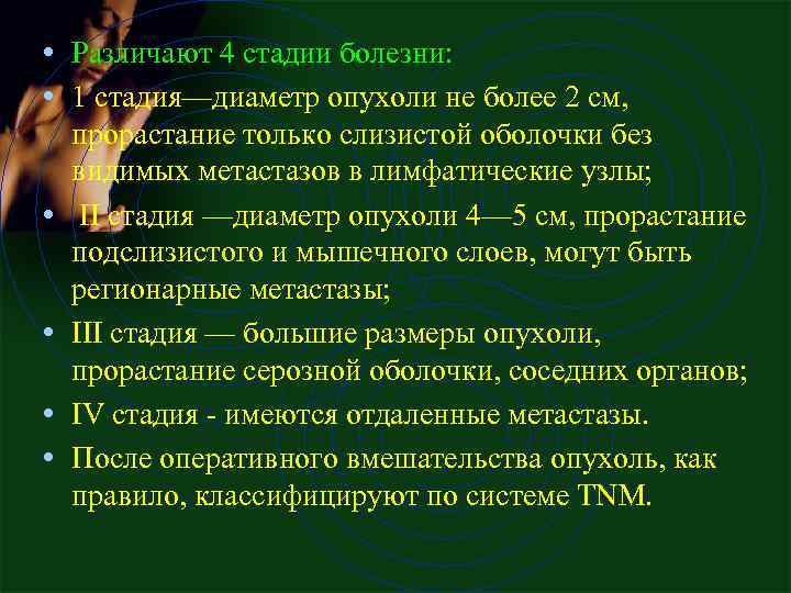  • Различают 4 стадии болезни: • 1 стадия—диаметр опухоли не более 2 см,