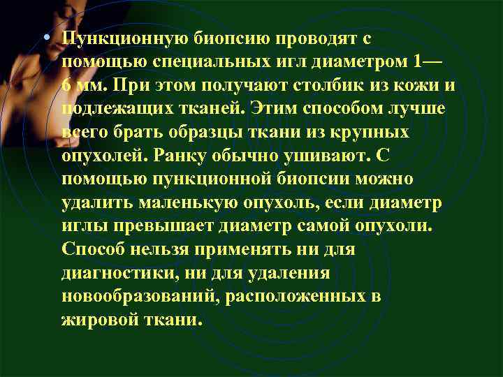  • Пункционную биопсию проводят с помощью специальных игл диаметром 1— 6 мм. При