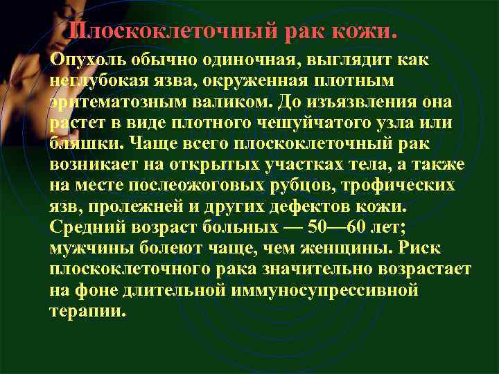  Плоскоклеточный рак кожи. Опухоль обычно одиночная, выглядит как неглубокая язва, окруженная плотным эритематозным