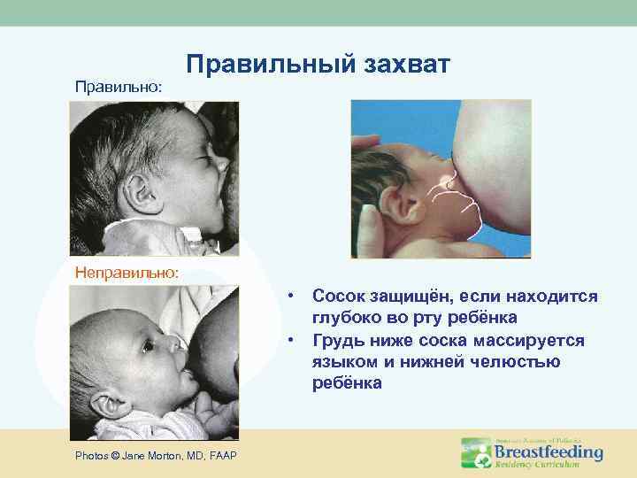 Правильно: Правильный захват Неправильно: • Сосок защищён, если находится глубоко во рту ребёнка •