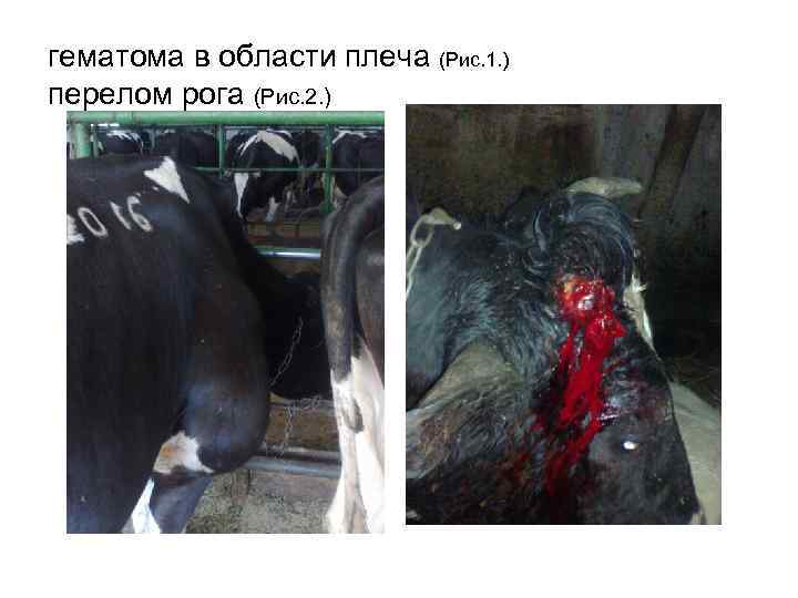 гематома в области плеча (Рис. 1. ) перелом рога (Рис. 2. ) 