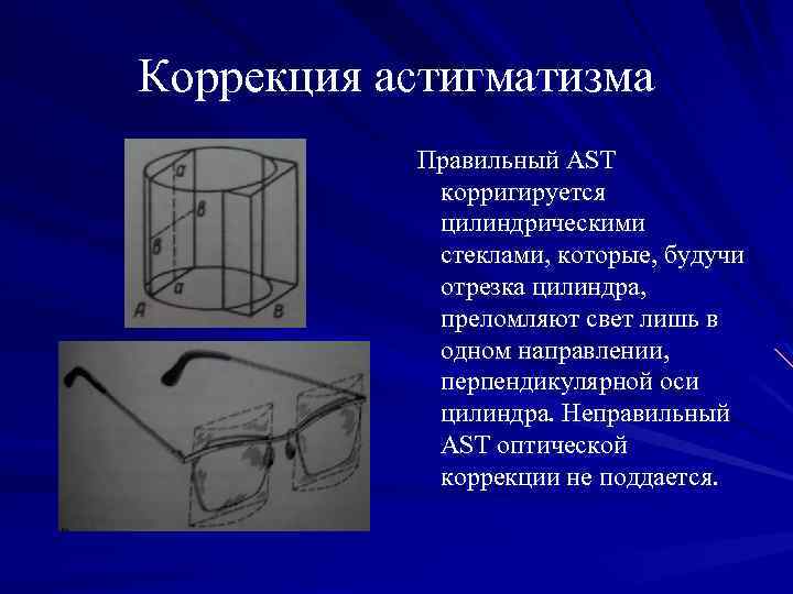 Коррекция астигматизма Правильный AST корригируется цилиндрическими стеклами, которые, будучи отрезка цилиндра, преломляют свет лишь