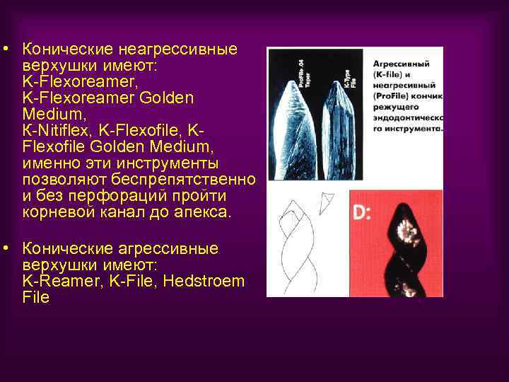  • Конические неагрессивные верхушки имеют: K-Flexoreamer, K-Flexoreamer Golden Medium, К-Nitiflex, K-Flexofile, KFlexofile Golden