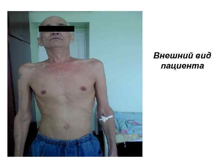 Внешний вид пациента 