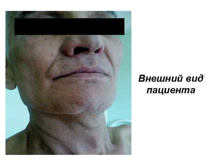 Внешний вид пациента 