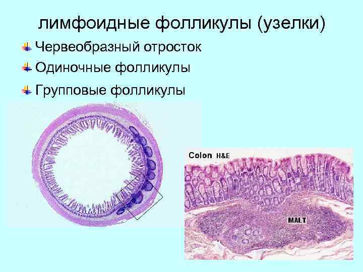 лимфоидные фолликулы (узелки) Червеобразный отросток Одиночные фолликулы Групповые фолликулы 
