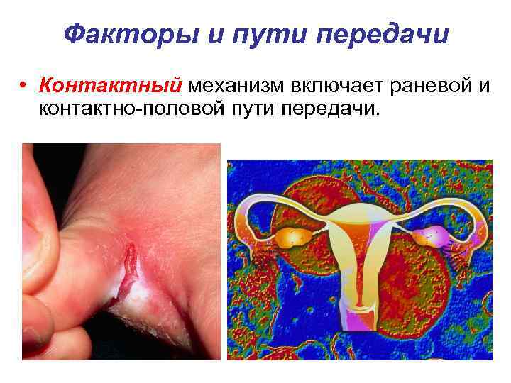 Факторы и пути передачи • Контактный механизм включает раневой и контактно-половой пути передачи. 