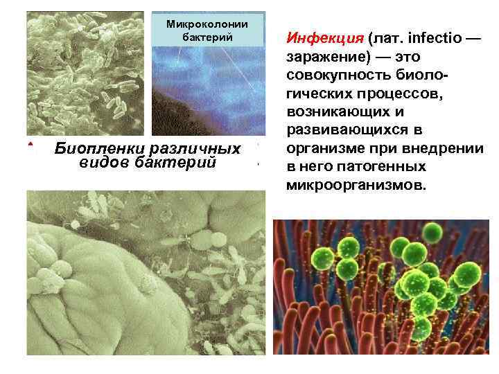 Основные бактериальные инфекции