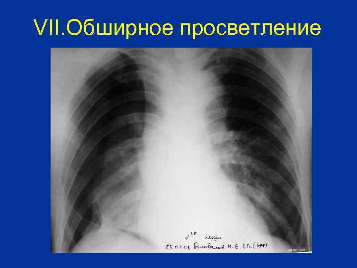 VII. Обширное просветление 