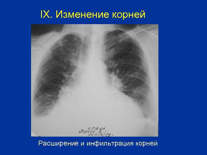IX. Изменение корней Расширение и инфильтрация корней 
