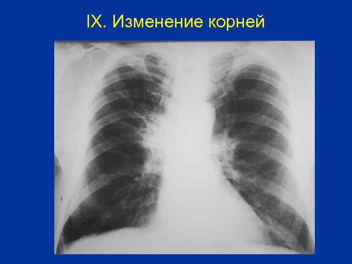 IX. Изменение корней 