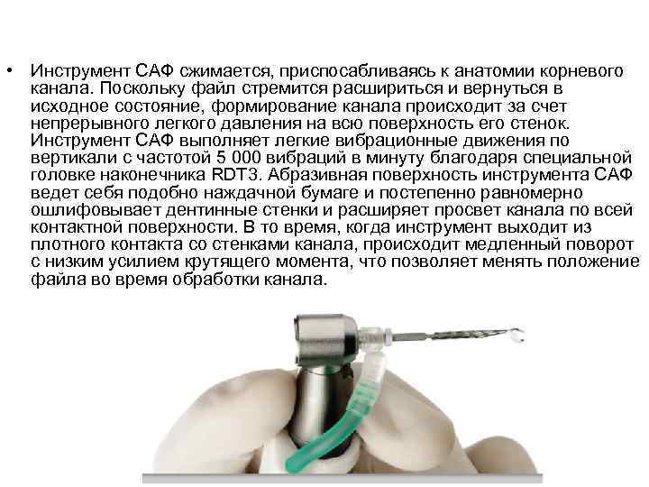  • Инструмент САФ сжимается, приспосабливаясь к анатомии корневого канала. Поскольку файл стремится расшириться