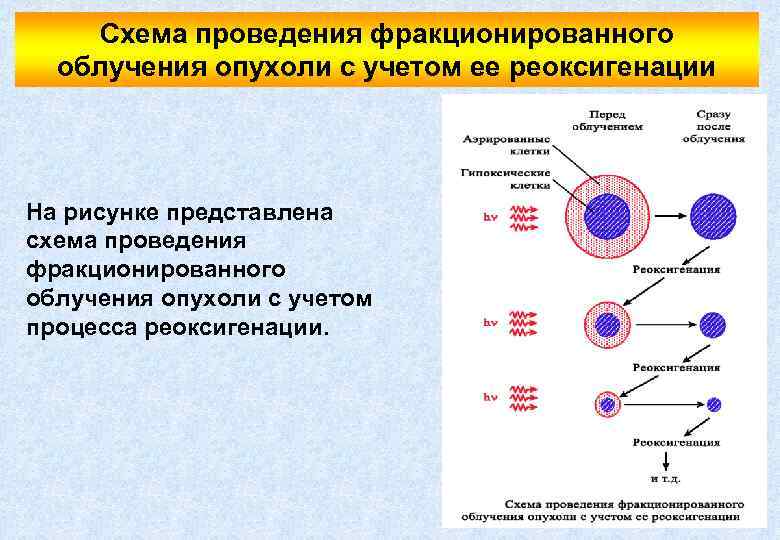 Схема проведения фракционированного облучения опухоли с учетом ее реоксигенации На рисунке представлена схема проведения