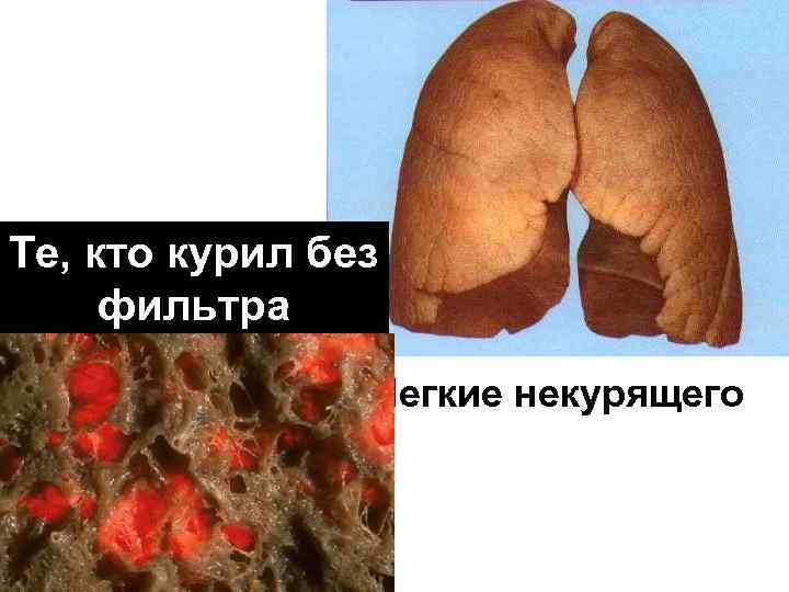 Те, кто курил без фильтра Легкие некурящего 