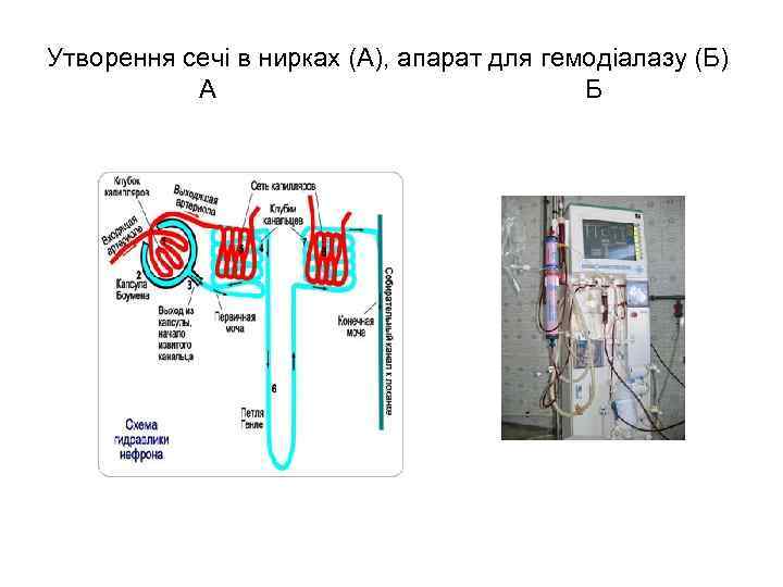 Утворення сечі в нирках (А), апарат для гемодіалазу (Б) А Б 