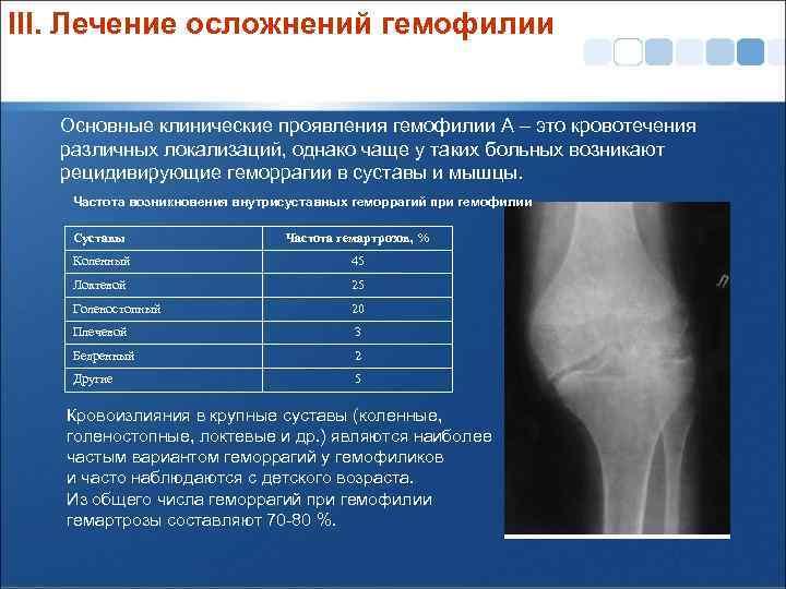 III. Лечение осложнений гемофилии Основные клинические проявления гемофилии А – это кровотечения различных локализаций,