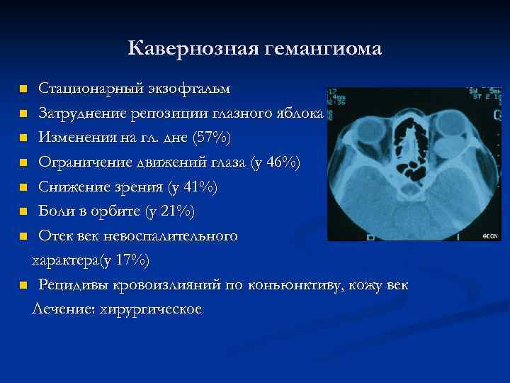 Мр картина множественных супратенториальных очагов глиоза