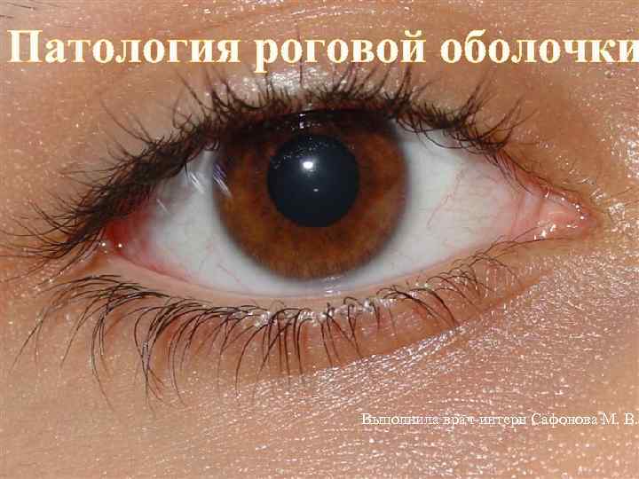 Патология роговой оболочки Выполнила врач-интерн Сафонова М. В. 