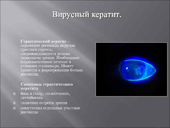 Вирусный кератит. Герпетический кератит – поражение роговицы вирусом простого герпеса, сопровождающееся резким снижением зрения.