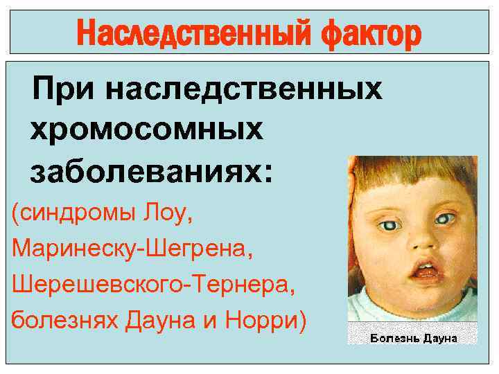 Наследственный фактор При наследственных хромосомных заболеваниях: (синдромы Лоу, Маринеску-Шегрена, Шерешевского-Тернера, болезнях Дауна и Норри)
