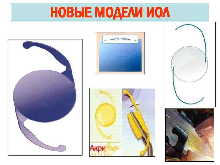 НОВЫЕ МОДЕЛИ ИОЛ 