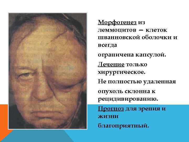 Морфогенез из леммоцитов — клеток шванновской оболочки и всегда ограничена капсулой. Лечение только хирургическое.