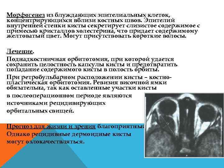 Морфогенез из блуждающих эпителиальных клеток, концентрирующихся вблизи костных швов. Эпителий внутренней стенки кисты секретирует