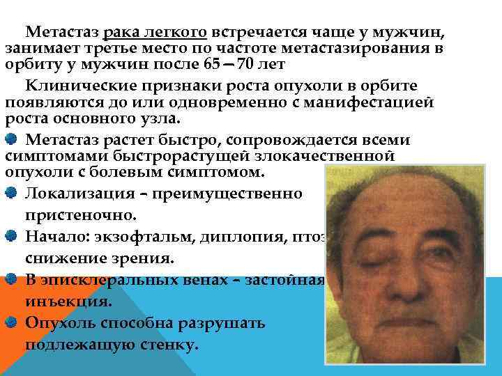 Метастаз рака легкого встречается чаще у мужчин, занимает третье место по частоте метастазирования в