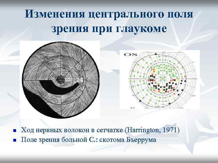 Поле зрения это. Центральная скотома периметрия. Скотома Бьеррума. Центральные скотомы в поле зрения. Скотома Бьеррума при глаукоме.