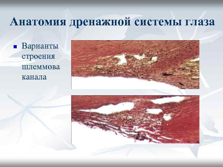 Анатомия дренажной системы глаза n Варианты строения шлеммова канала 