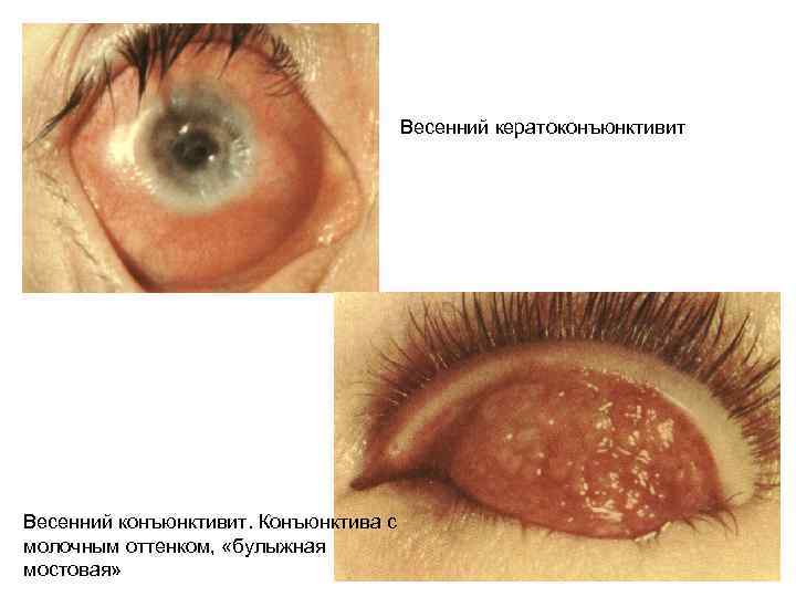 Пингвекула 