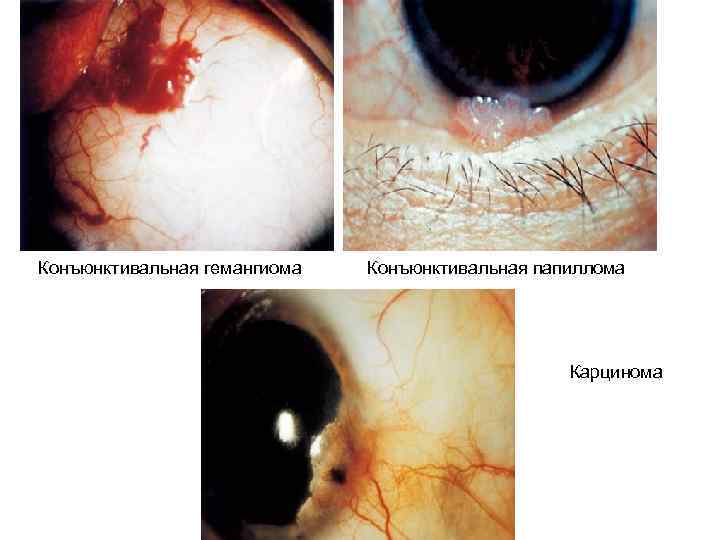 Патология орбиты 