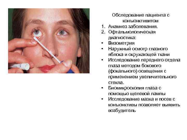    Острый бактериальный конъюнктивит. Этиология: стафилококки, пневмококки, синегнойная палочка и гонококк. Клиника: