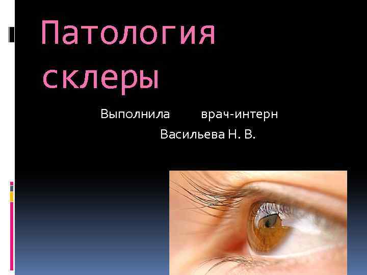 Патология склеры Выполнила врач-интерн Васильева Н. В. 