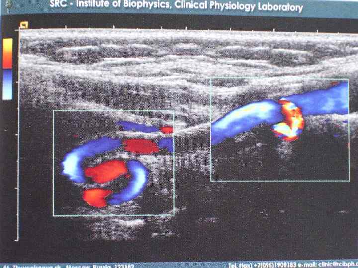 Распределение больных в зависимости от возраста. 