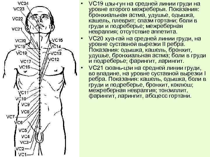  • VC 19 цзы-гун на средней линии груди на уровне второго межреберья. Показания: