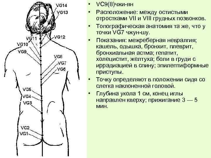  • VС 9(8)чжи-ян • Расположение: между остистыми отростками VIII грудных позвонков. • Топографическая