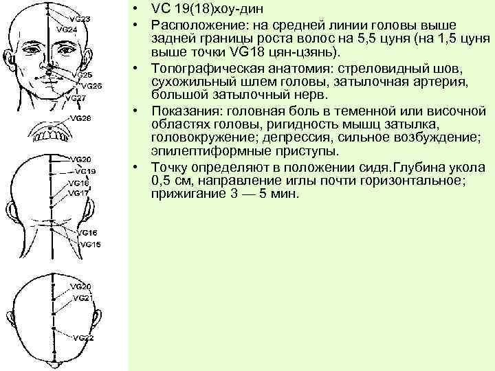  • VС 19(18)хоу-дин • Расположение: на средней линии головы выше задней границы роста