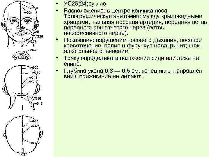  • УС 25(24)су-ляо • Расположение: в центре кончика носа. Топографическая анатомия: между крыловидными