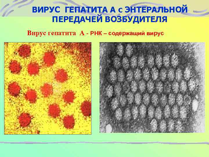 ВИРУС ГЕПАТИТА А с ЭНТЕРАЛЬНОЙ ПЕРЕДАЧЕЙ ВОЗБУДИТЕЛЯ Вирус гепатита А - РНК – содержащий