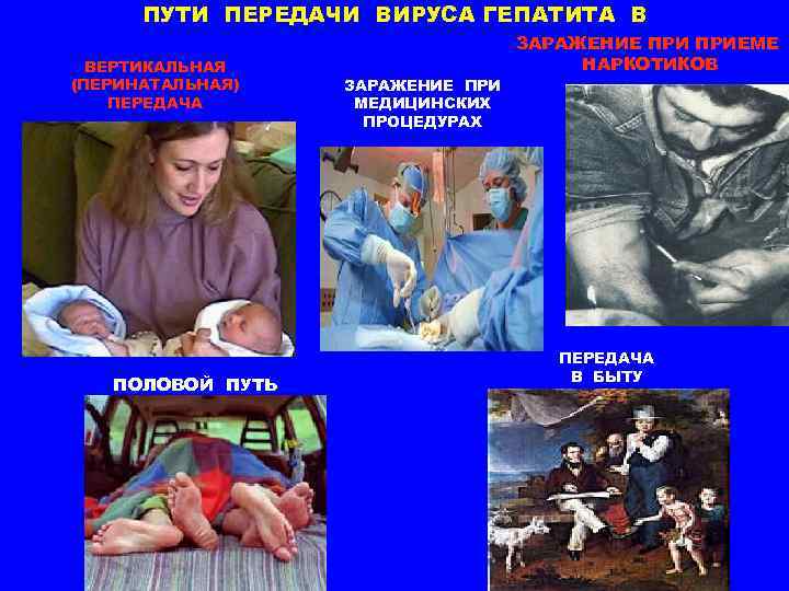 ПУТИ ПЕРЕДАЧИ ВИРУСА ГЕПАТИТА В ВЕРТИКАЛЬНАЯ (ПЕРИНАТАЛЬНАЯ) ПЕРЕДАЧА ПОЛОВОЙ ПУТЬ ЗАРАЖЕНИЕ ПРИ МЕДИЦИНСКИХ ПРОЦЕДУРАХ