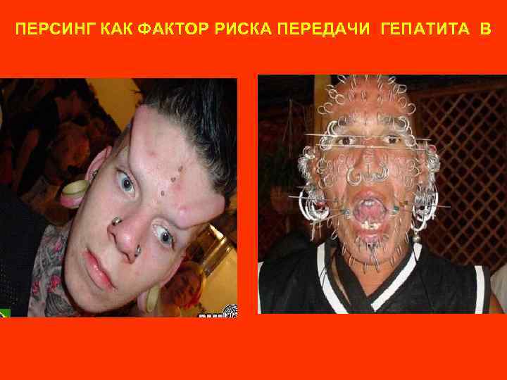 ПЕРСИНГ КАК ФАКТОР РИСКА ПЕРЕДАЧИ ГЕПАТИТА В 